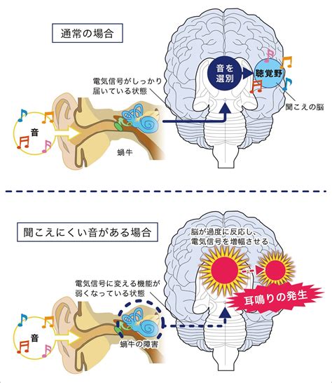 左耳鳴 時辰